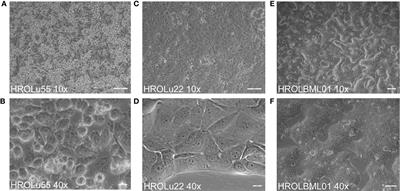 Establishment, characterization, and drug screening of low-passage patient individual non-small cell lung cancer in vitro models including the rare pleomorphic subentity